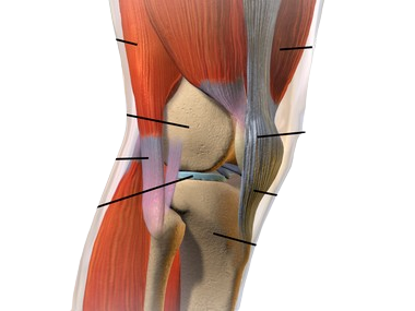 Osteoarthritis